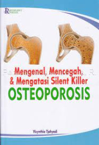 Mengenal, Mencegah, & Mengatasi Silent Killer Osteoporosis